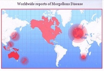 chemtrail-morgellons-map-small